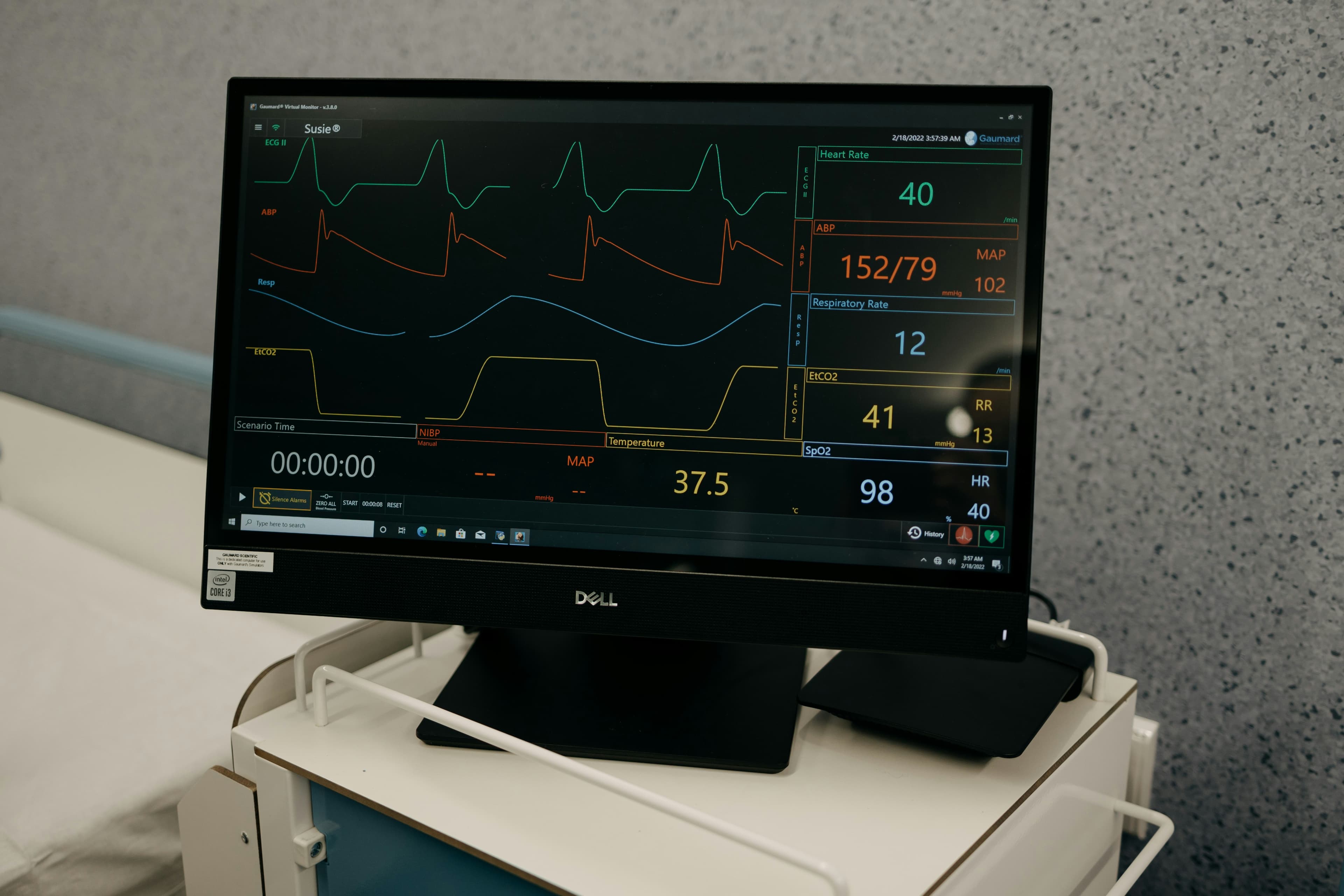 Monitor multiparamétrico mostrando trazos de ECG y signos vitales