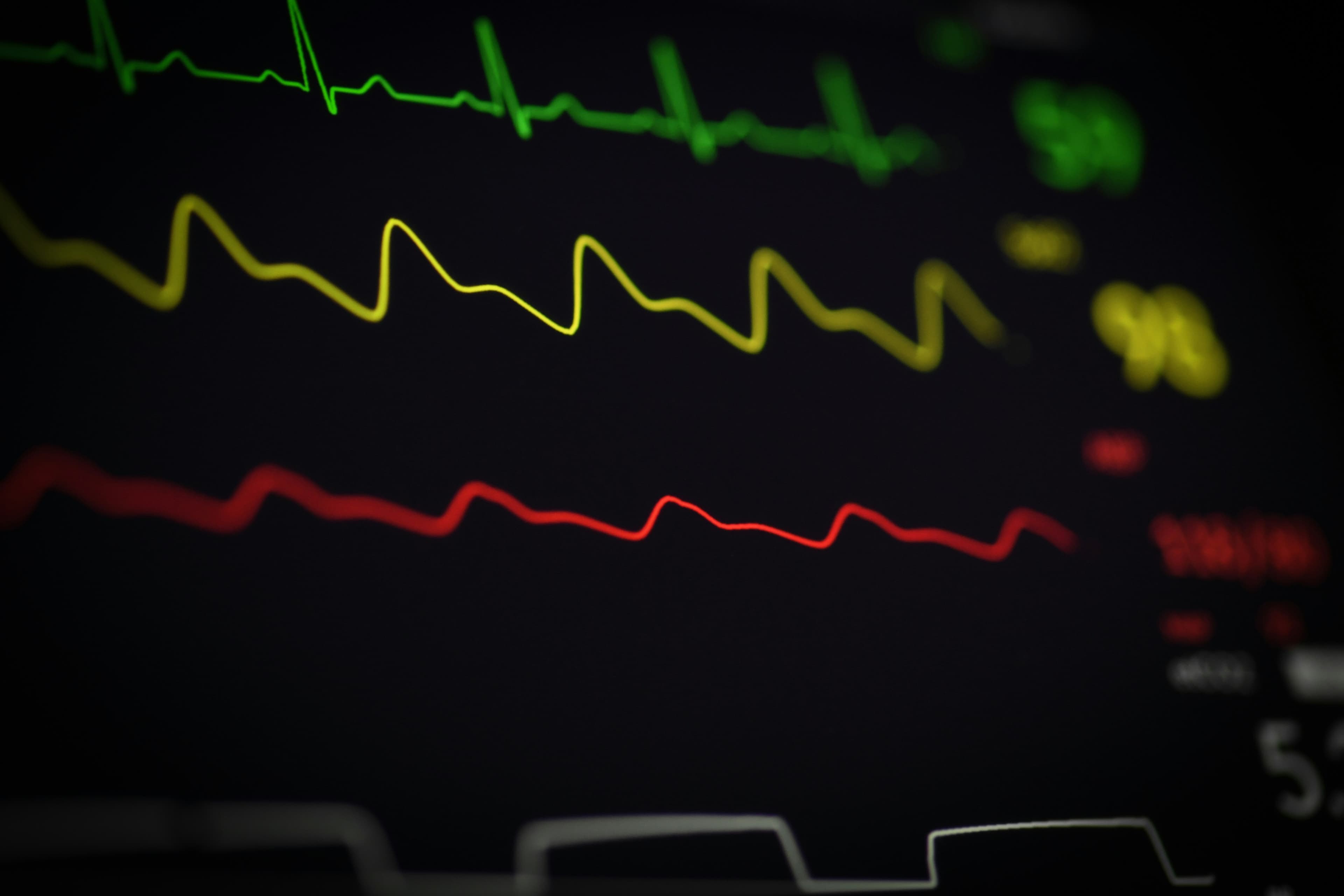 Monitor de signos vitales con trazado de ECG en urgencias