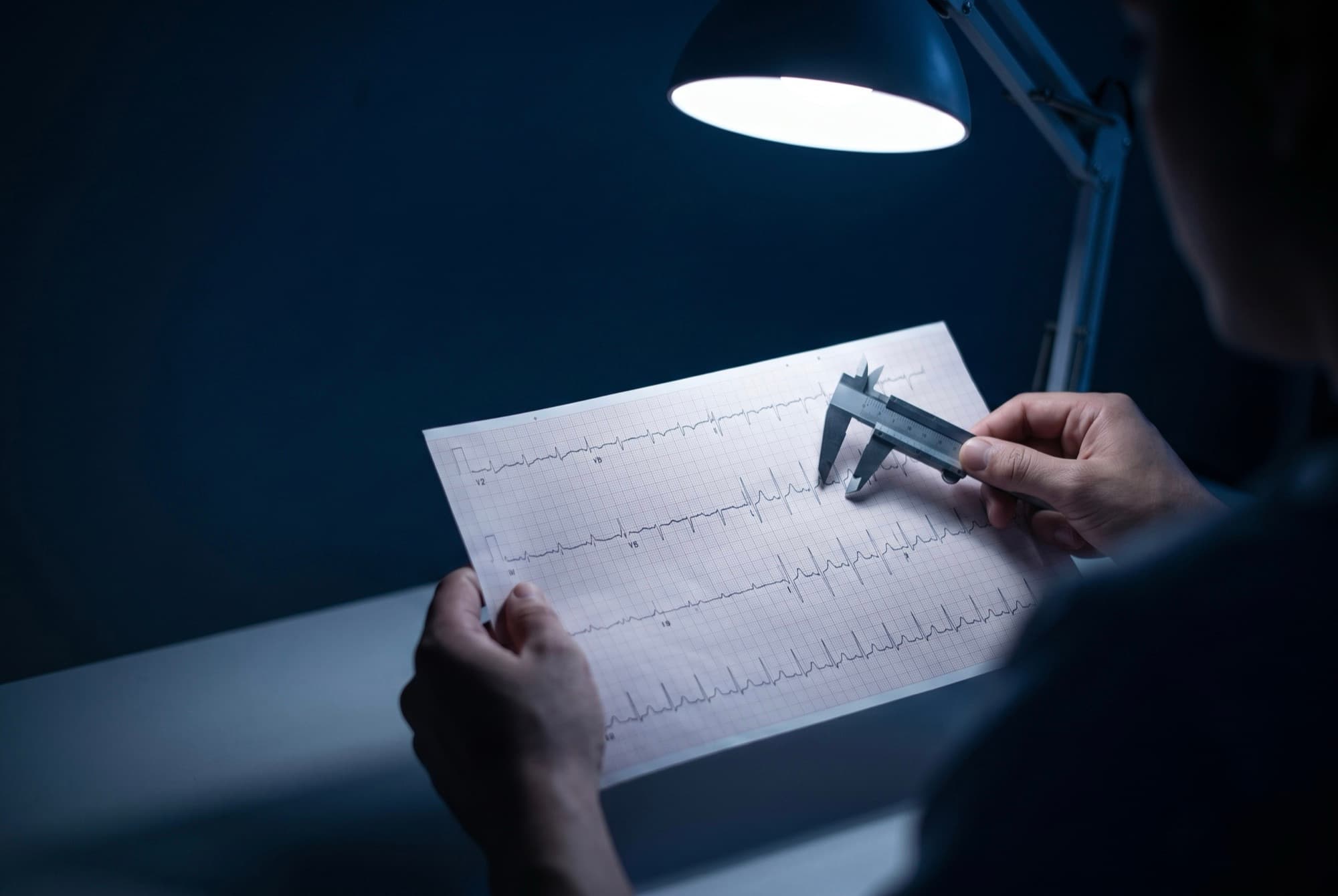 Manos sosteniendo un trazo de electrocardiograma de 12 derivaciones con un calibrador