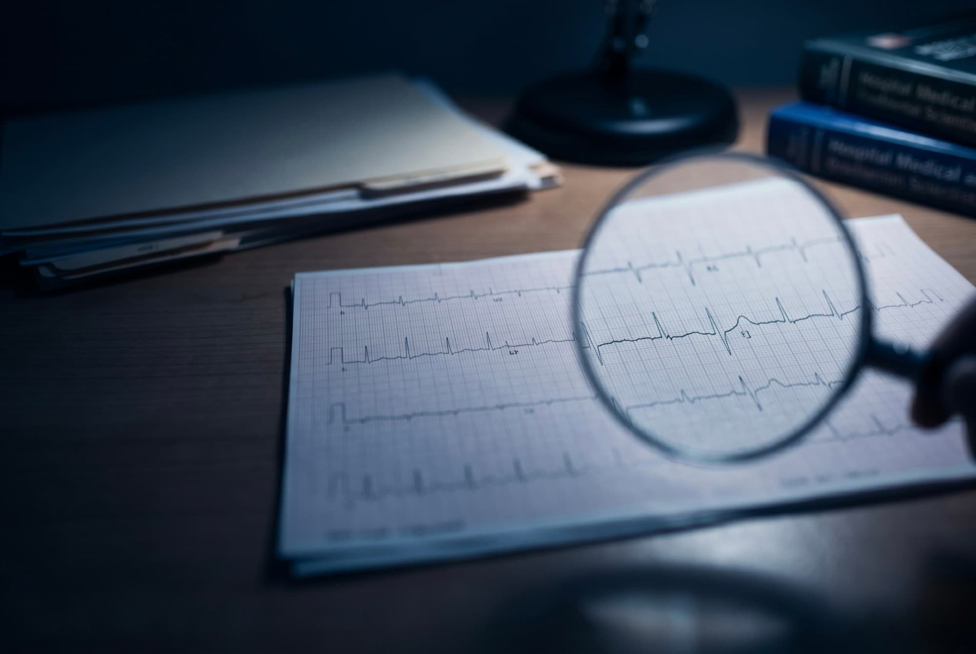Trazo de electrocardiograma de 12 derivaciones bajo una lupa sobre un escritorio, con libros médicos detrás
