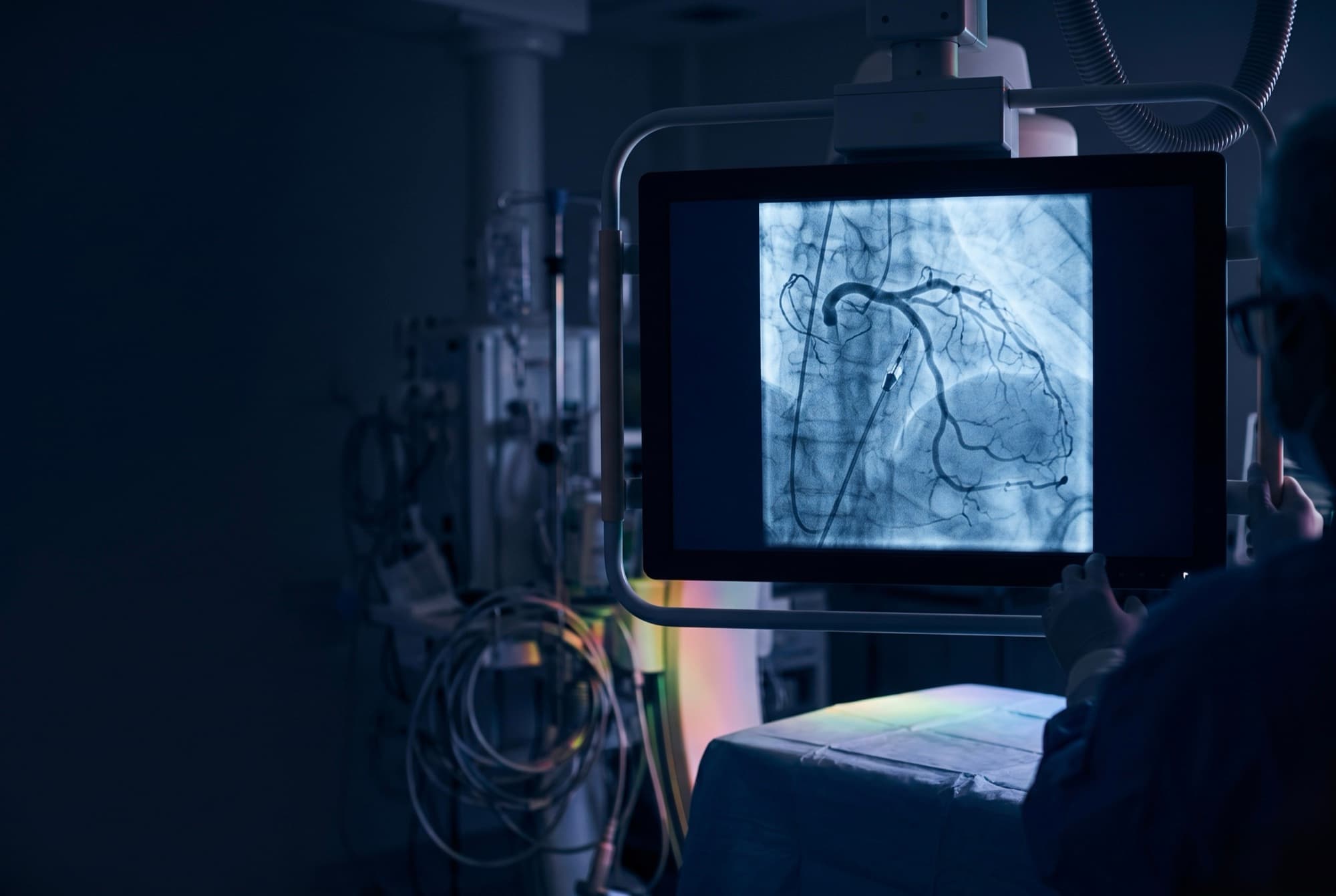 Angiograma coronario iluminado en el monitor de una sala de hemodinamia